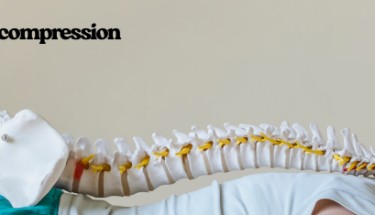 Alivio de espalda sin cirugía: terapia de descompresión espinal explicada